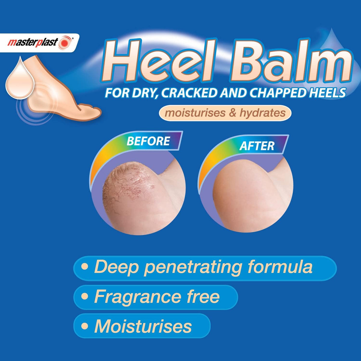 Advertisement for Masterplast Heel Balm showing before and after effects on dry skin.