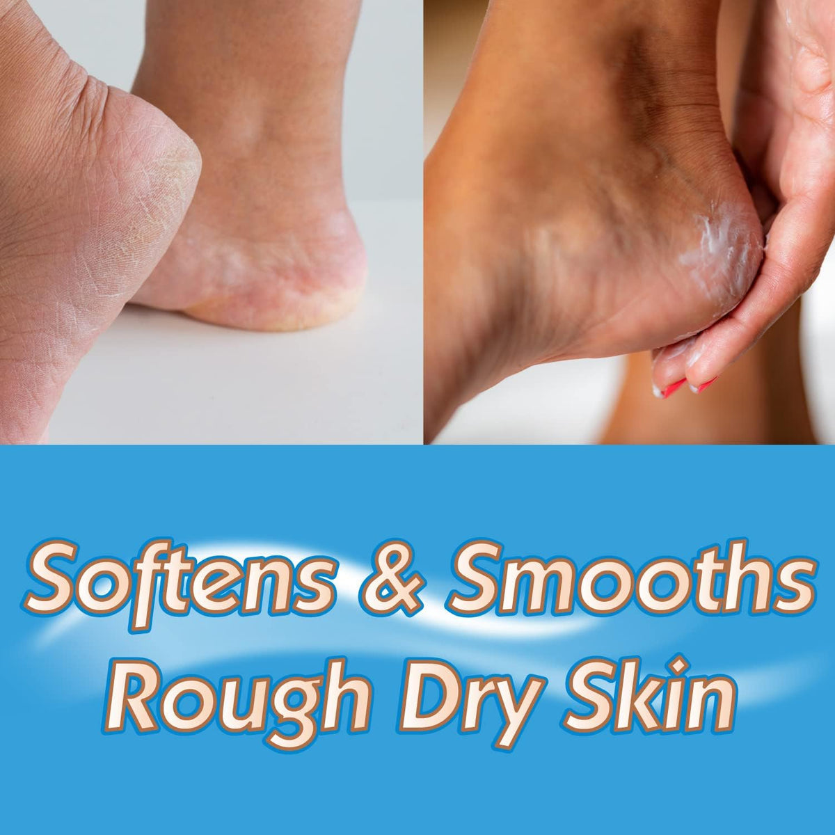 Before and after comparison of rough dry skin being smoothed with heel balm, on a blue background with text 'Softens & Smooths Rough Dry Skin'.